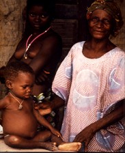 Three generations. Grandmother, mother, and daughter in their home outside Masanga Leprosy Hospital in Sierra Leone. Their village and the hospital were destroyed during bush fighting a few months after this photo was taken. Photographer: James Li, M.D.